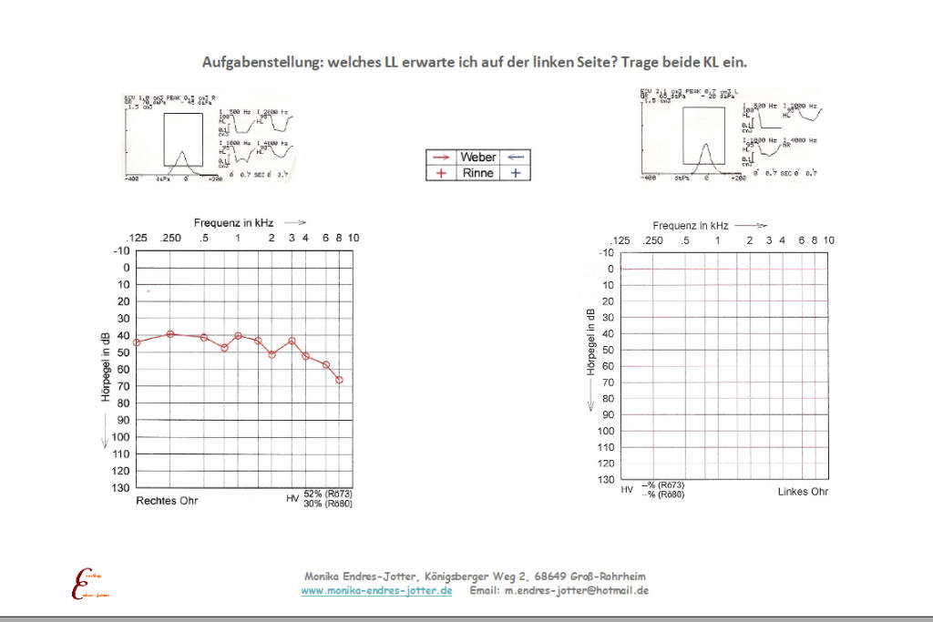 . Welche Messung erwarte ich auf dem linken Ohr